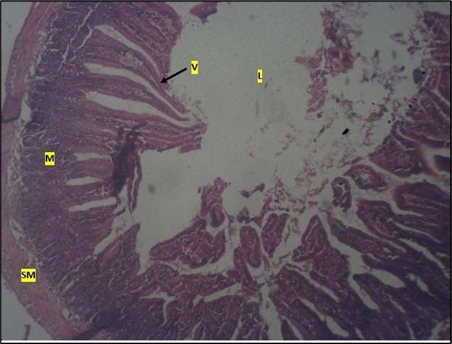 Journal of Public Health International-Large intestine