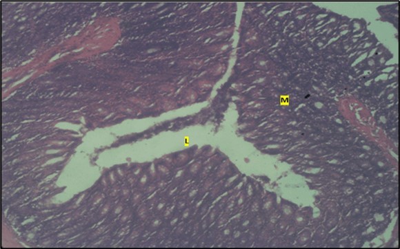 Journal of Public Health International-Large intestine