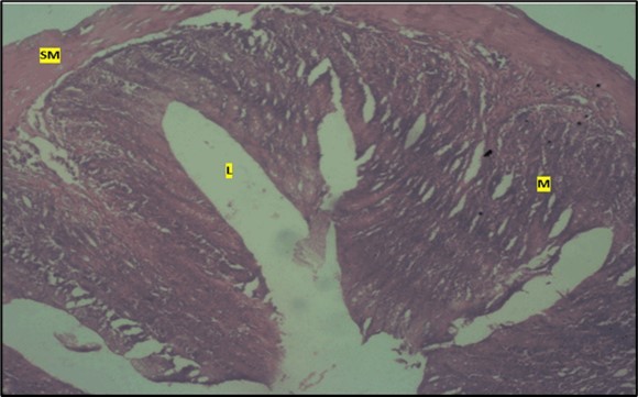 Journal of Public Health International-Large intestine