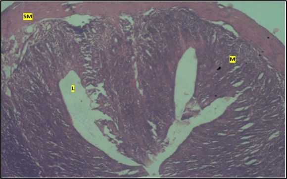 Journal of Public Health International-Large intestine