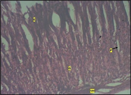 Journal of Public Health International-Large intestine