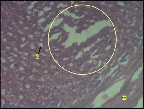 Journal of Public Health International-Large intestine