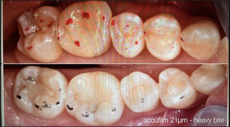 Journal of Dentistry And Oral Implants-Occlusion