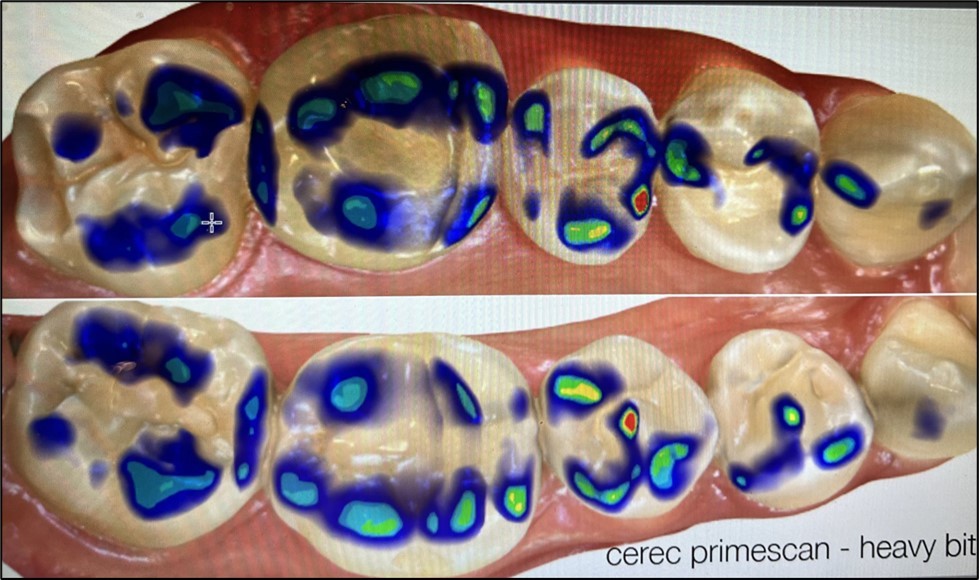 Journal of Dentistry And Oral Implants-Occlusion