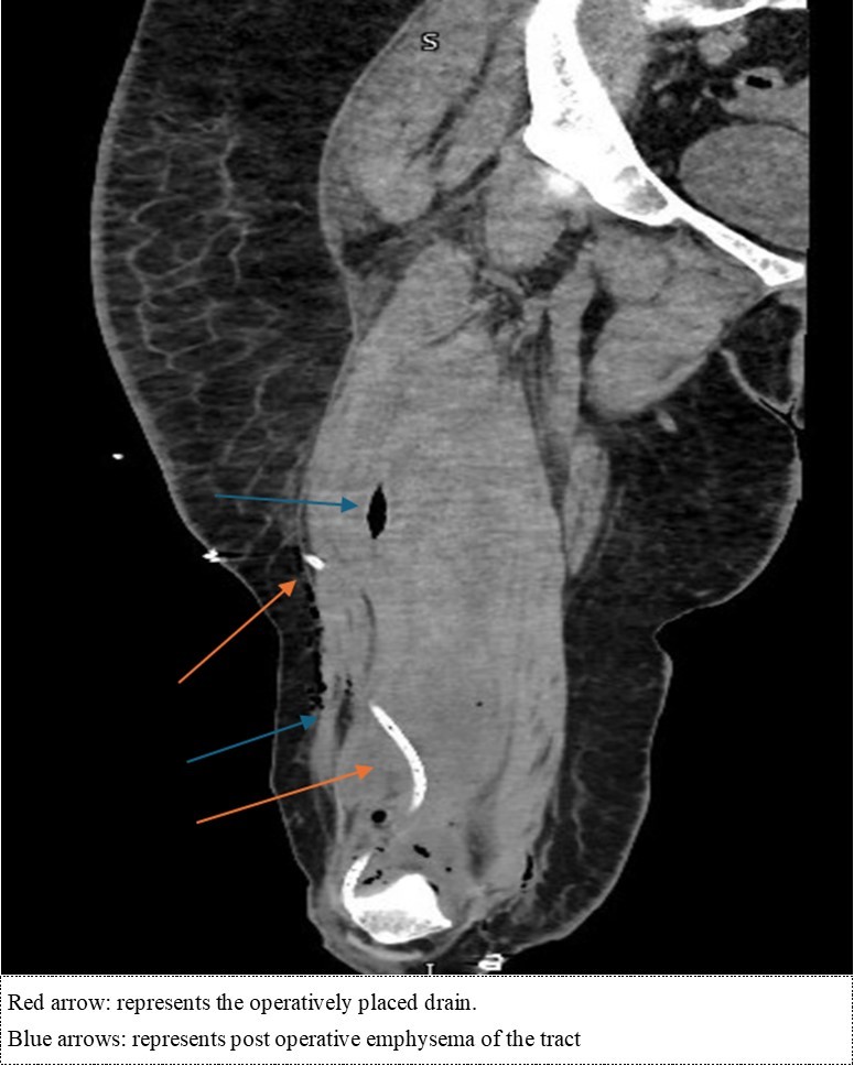 Journal of Sports and Exercise Medicine - Knee Septic Arthritis