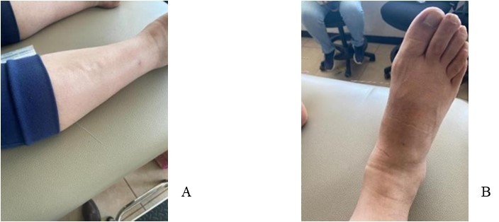 International Journal of Complementary Medicine - Spleen and Stomach Meridians