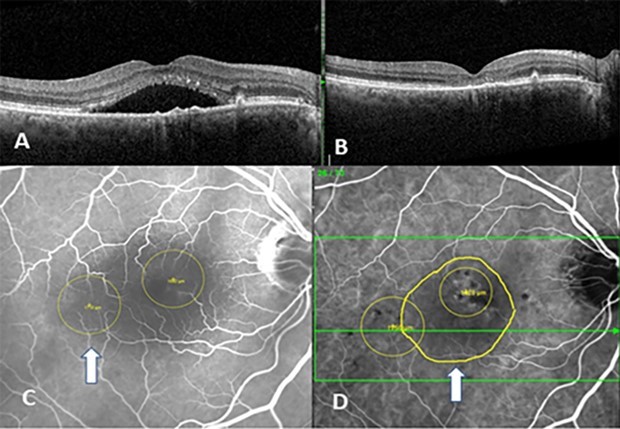 Journal of Ophthalmic Science - Optical Coherent Tomography (Angiography)