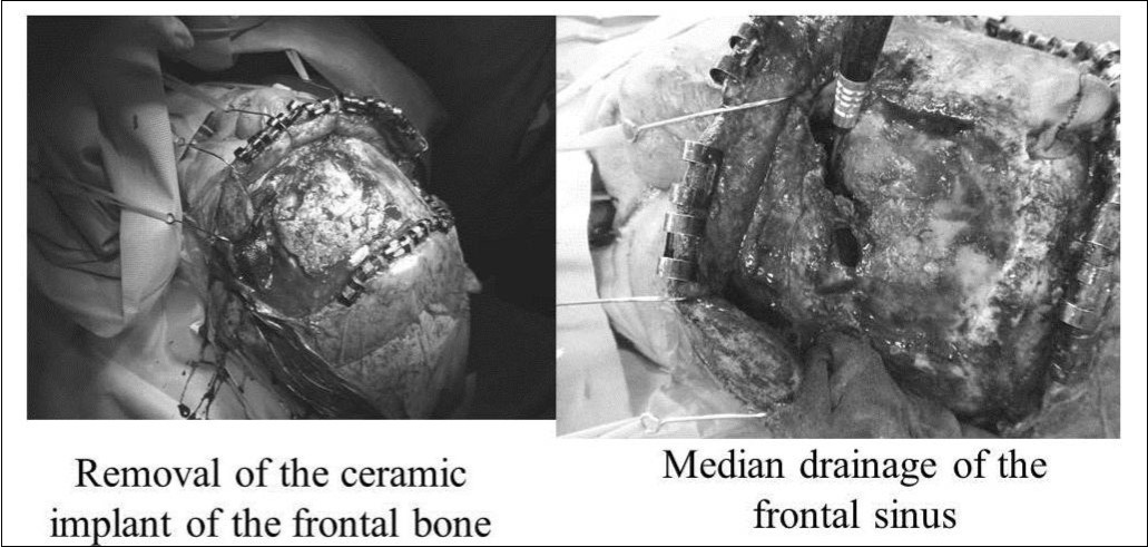 Journal of Otolaryngology Advances-CT