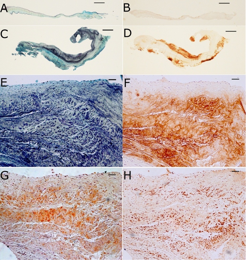Journal of Hypertension and Cardiology-mitral valve