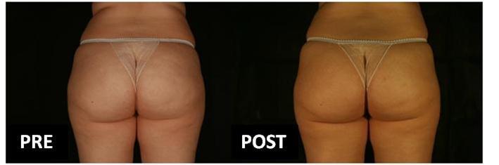 International Journal of Nutrition-Diet