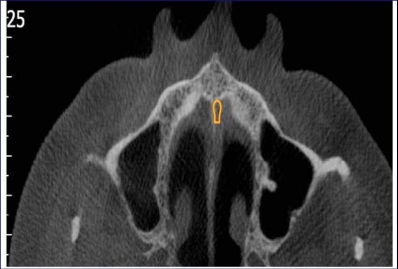 Journal of Dentistry And Oral Implants-CBCT