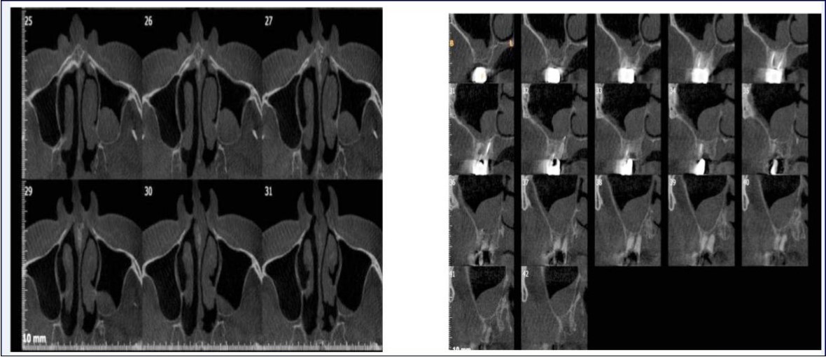 Journal of Dentistry And Oral Implants-CBCT