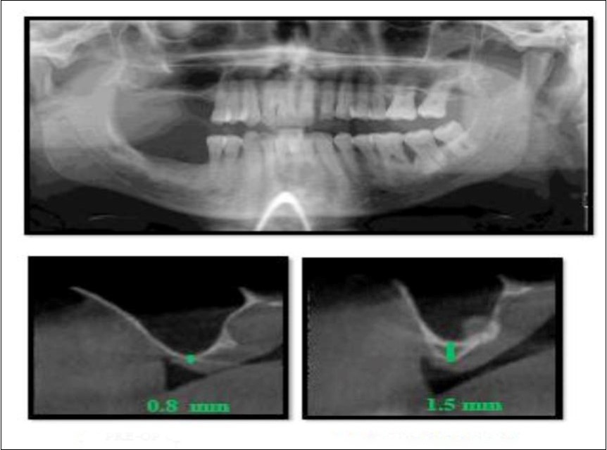 Journal of Dentistry And Oral Implants-CBCT