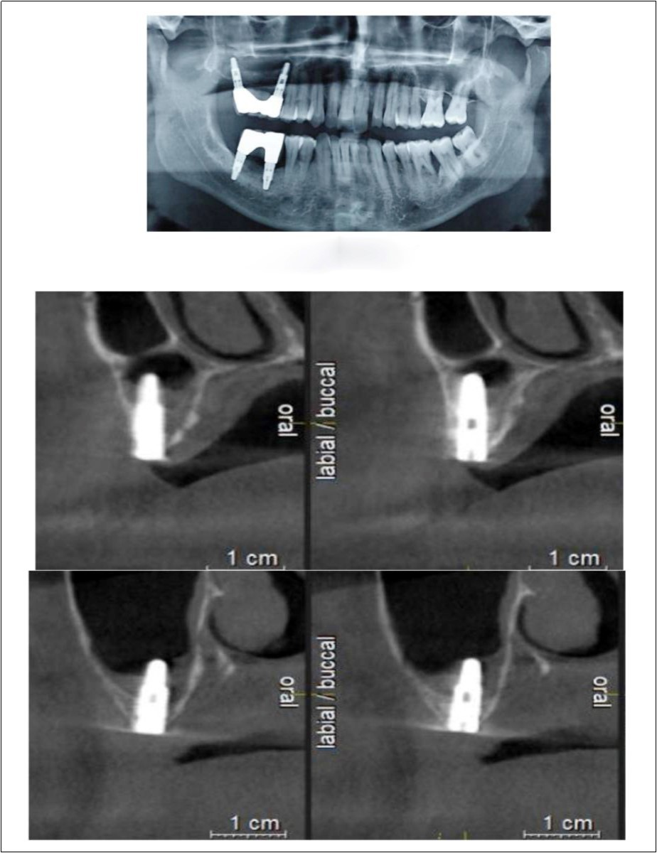 Journal of Dentistry And Oral Implants-CBCT