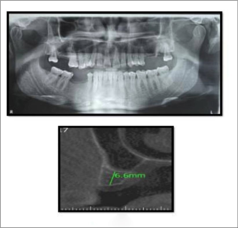 Journal of Dentistry And Oral Implants-CBCT