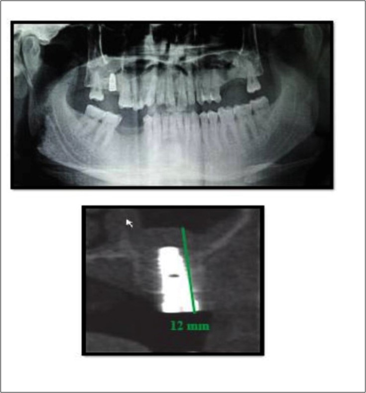 Journal of Dentistry And Oral Implants-CBCT