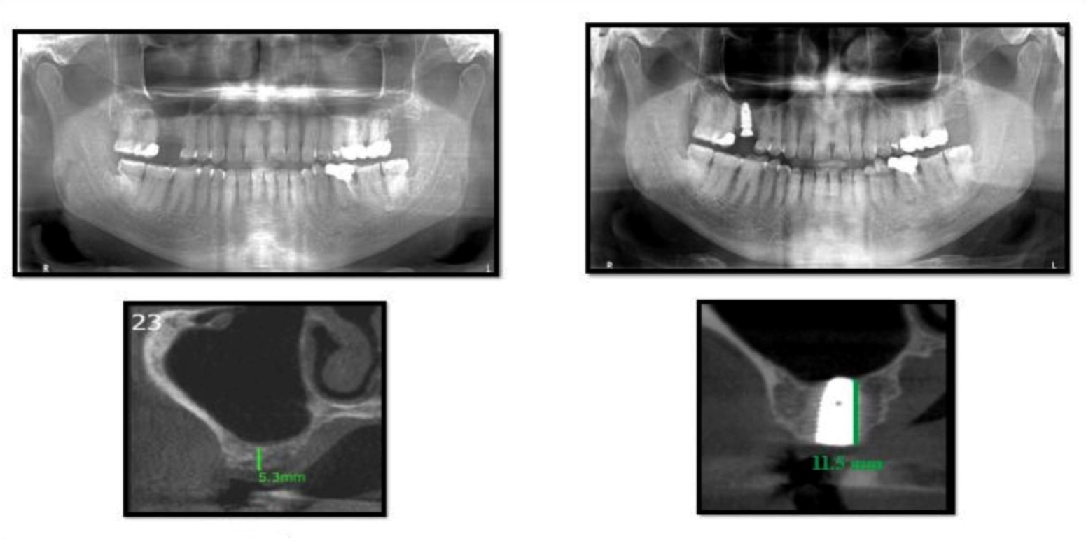 Journal of Dentistry And Oral Implants-CBCT