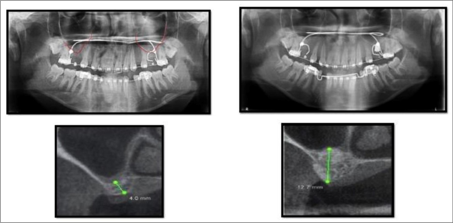 Journal of Dentistry And Oral Implants-CBCT
