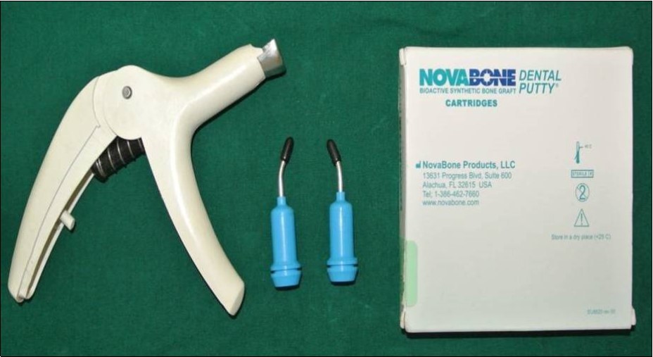 Journal of Dentistry And Oral Implants-Indirect sinus augmentation