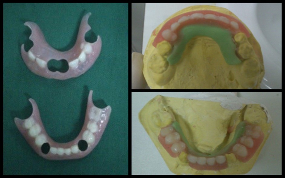 Journal of Dentistry And Oral Implants-Ellis-Van Creveld syndrome