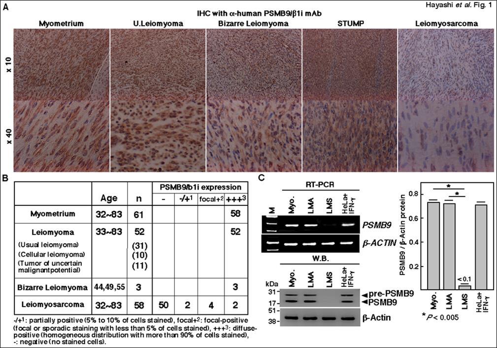 Journal Of Cancer Genetics And Biomarkers-PSMB9/b1i