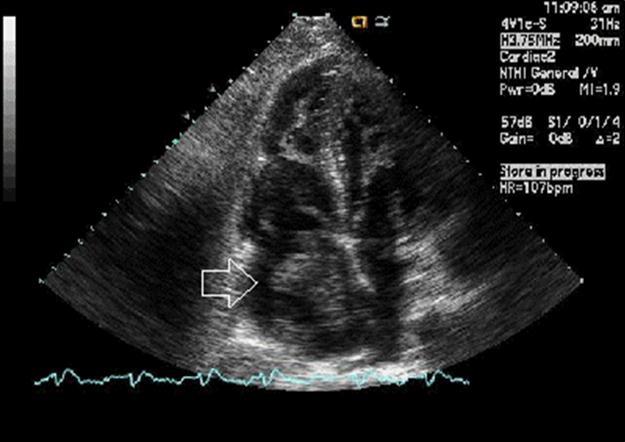Journal Of Keyhole Surgery Proceedings-Echocardiography