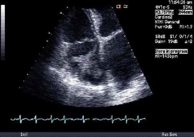 Journal Of Keyhole Surgery Proceedings-Echocardiography