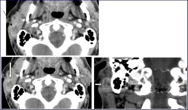 Journal Of Digestive Disorders And Diagnosis-parotid gland