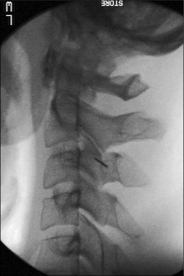 Journal of Otolaryngology Advances-Somatosensory Tinnitus