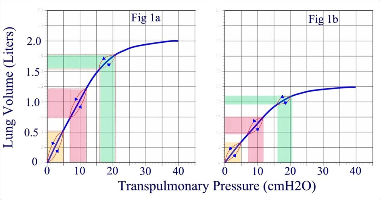 Journal of Sleep and Sleep Disorder Research-obstructive sleep apnea