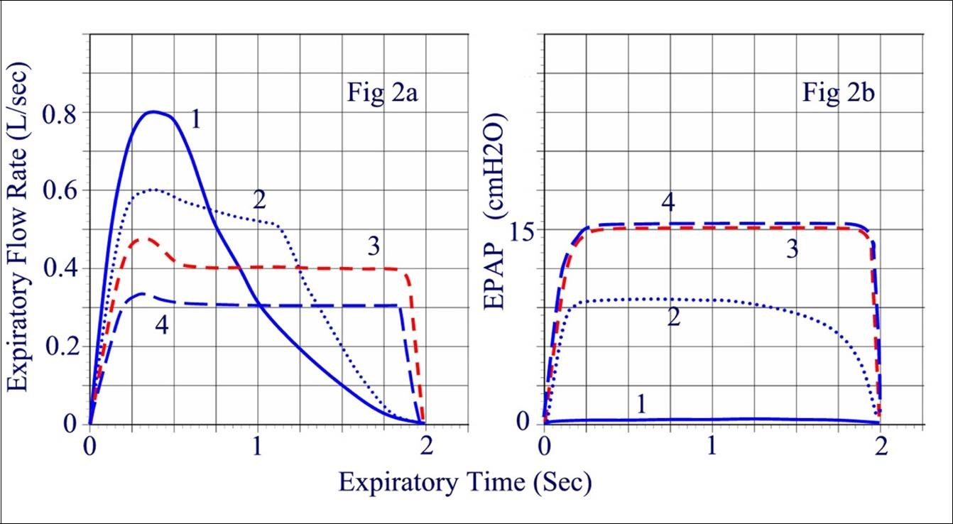 Journal of Sleep and Sleep Disorder Research-obstructive sleep apnea