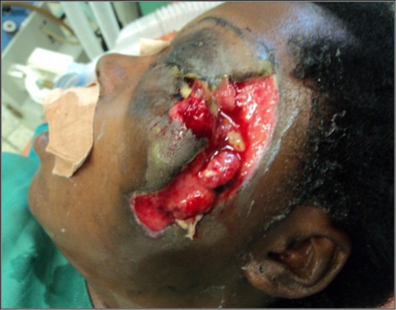 Journal Of Dentistry And Oral Implants-FISS