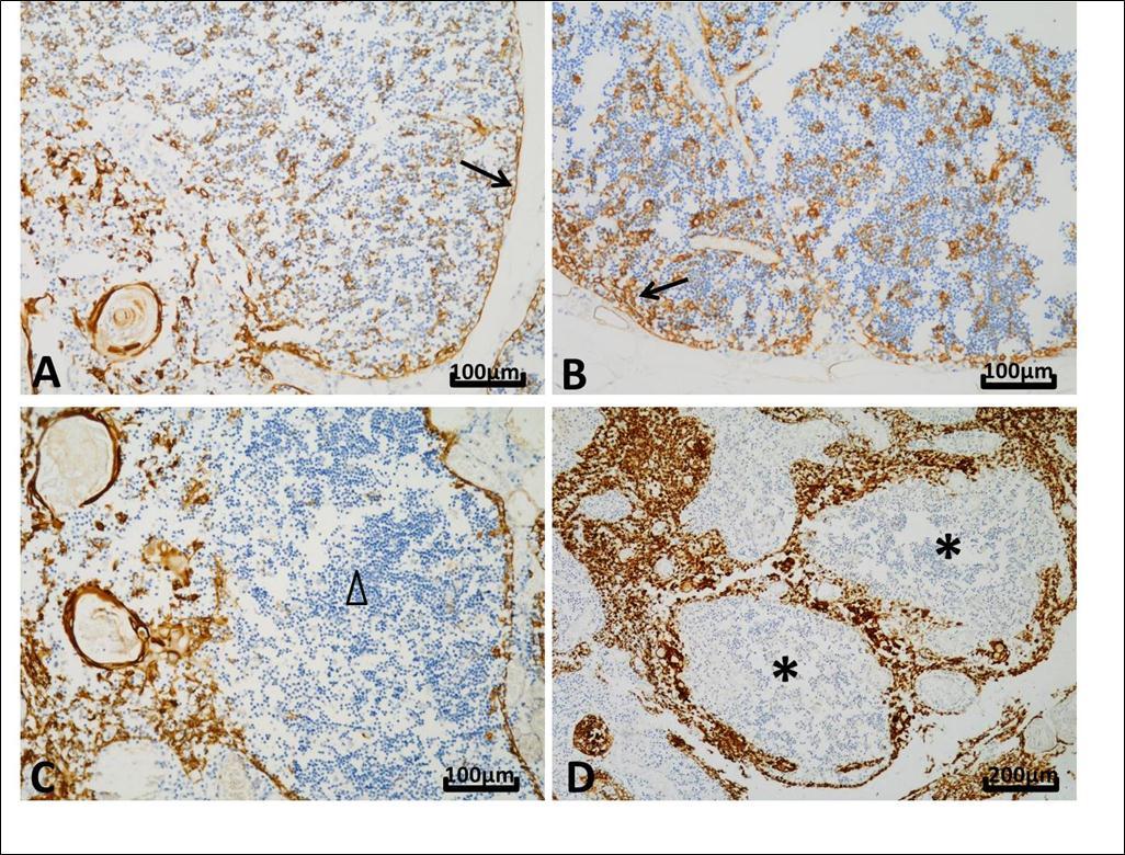 International Journal of Human Anatomy-Thymic hypertrophy