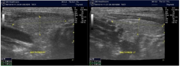 Journal of Hematalogy and Oncology Research-Thyroid Gland