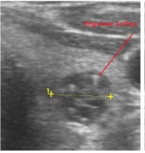 Journal of Hematalogy and Oncology Research-Thyroid Gland