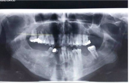 Journal of Otolaryngology Advances-KCOT