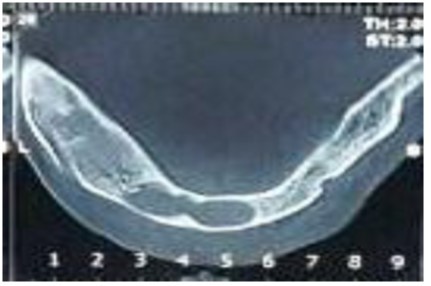 Journal of Otolaryngology Advances-KCOT