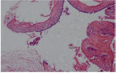 Journal of Otolaryngology Advances-KCOT