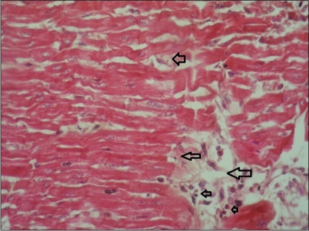 Journal of Immunization-FMDV