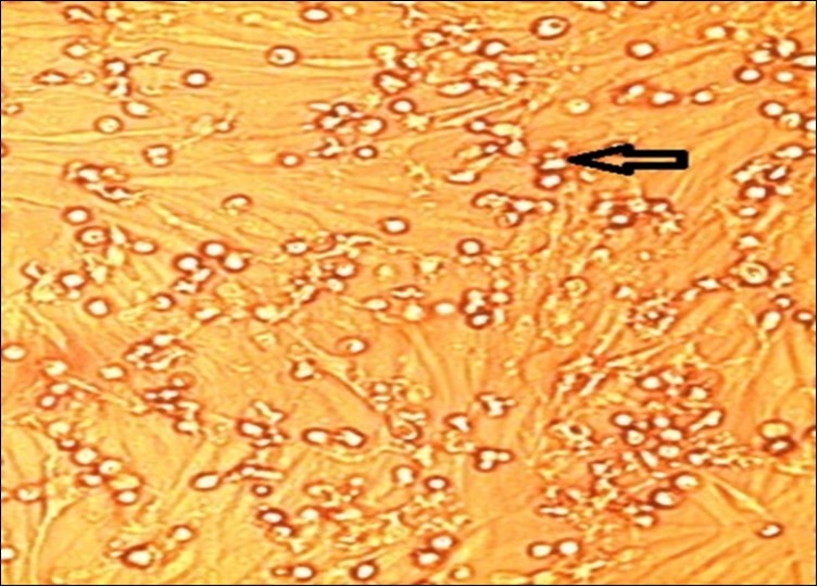 Journal of Immunization-FMDV