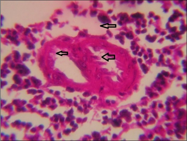 Journal of Immunization-FMDV