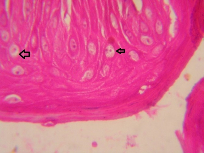 Journal of Immunization-FMDV