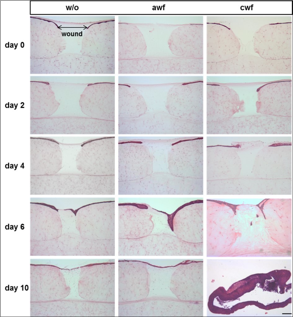 Journal of Tissue Repair and Regeneration-3D wound model