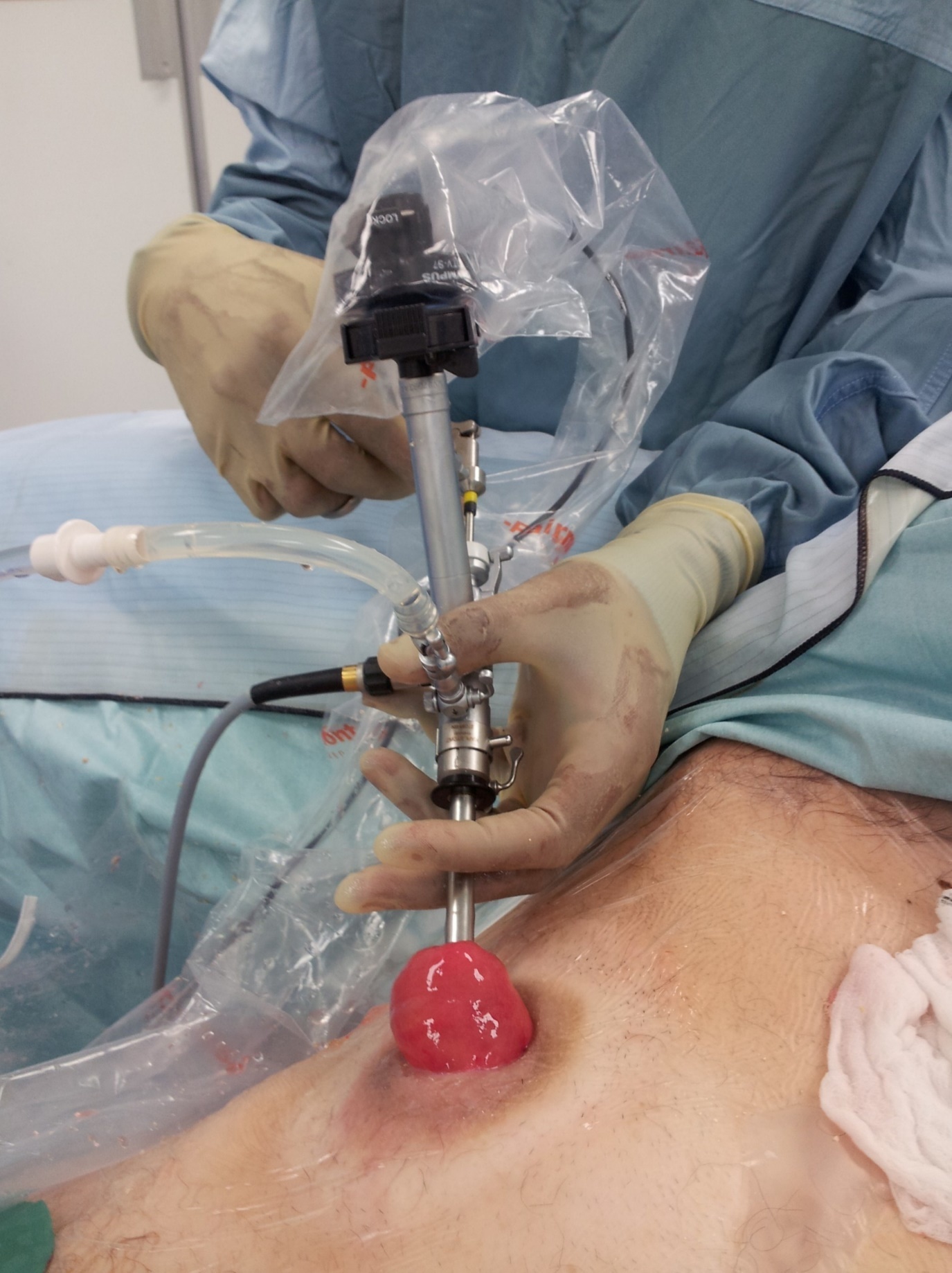 Journal of Medical and surgical Urology-ileal condiut