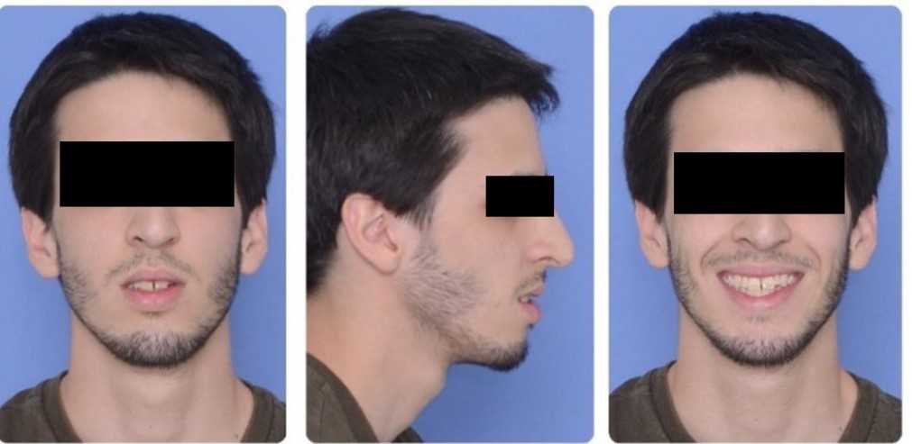 Journal Dental and Oral Implants -Orthodontics