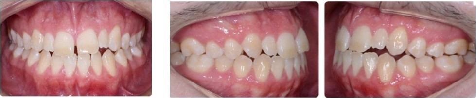 Journal Dental and Oral Implants -Orthodontics