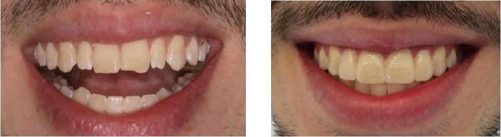 Journal Dental and Oral Implants -Orthodontics