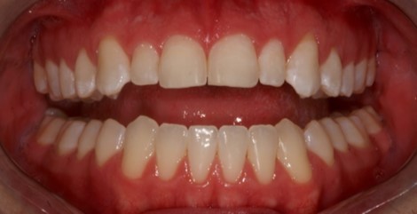 Journal Dental and Oral Implants -Orthodontics