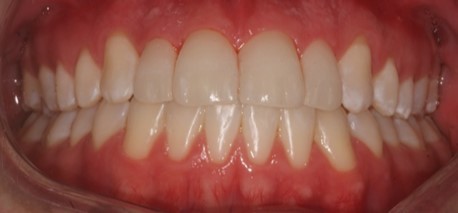 Journal Dental and Oral Implants -Orthodontics
