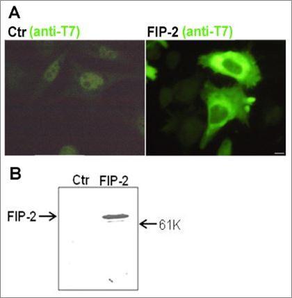 Journal of Proteomics and Genomics Research-FIP-2 (optineurin)